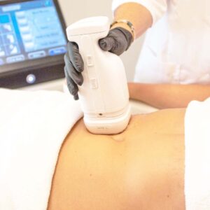 HIFU Liposonix Corporal